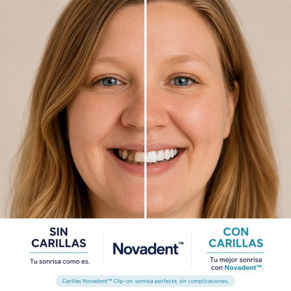 Novadent™ - Carillas Dentales
